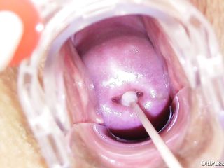 Гинеколог проводит осмотр у студентки и лазит инструментами в её вагине